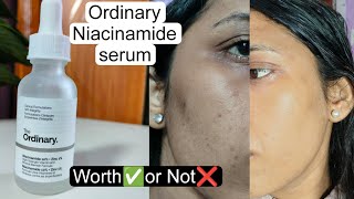 The Ordinary Niacinamide serum Review  Truth about Ordinary NiacinamideTrying Most Hyped Skincare [upl. by Brandise624]