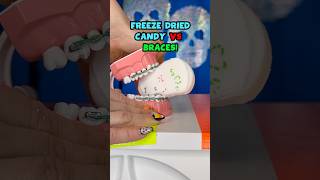 Is FREEZE DRIED CANDY safer for BRACES Orthodontist Tries and REACTS braces candy shorts [upl. by Hpotsirhc148]