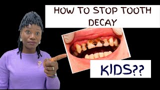 How To STOP Tooth DECAY in KIDSCause TreatmentsPrevention Dental Therapist EXPLAIN hannaholaoye [upl. by Delcine]