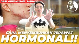 CARA MENYEMBUHKAN JERAWAT HORMONAL DARI YG MURAH SAMPE YG MAHAL  BEAUTY TIPS [upl. by Beckie359]