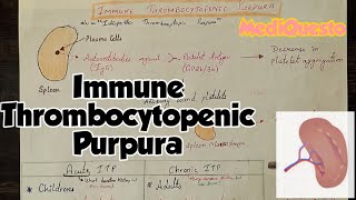 Immune Thrombocytopenic Purpura PlateletDisorders Hematology RobbinsPathology [upl. by Ayikal149]