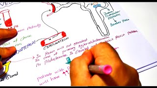 Hyperaldosteronism part II Investigation  approach to diagnosis  treatment [upl. by Naed]