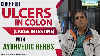 Cure for Ulcers in Colon Large Intestine with Ayurvedic Herbs [upl. by Sax]