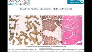 Introduction to Myopathies and Muscular Dystrophy [upl. by Nilved]