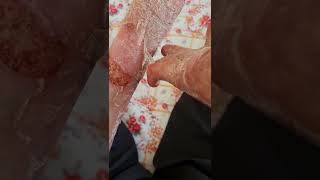 How to peel off dead skin  ASMR [upl. by Almita986]