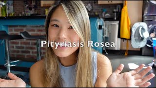 Skin Journey Part 1  My Experience with Pityriasis Rosea [upl. by Fonseca]