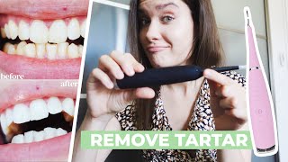 HOW TO REMOVE CALCULUS TARTAR PLAQUE AT HOME  Ultrasonic Tooth Cleaner Review  Does It Work [upl. by Inneg]