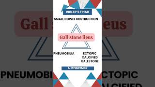 Riglers Triad Key Signs of Gallstone Ileus Explained gallbladderproblems MedicalEducation [upl. by Keyek]