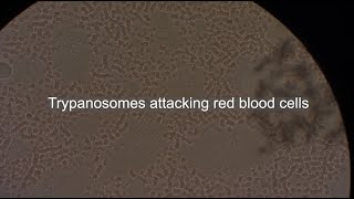 Trypanosomes attacking red blood cells [upl. by Daitzman238]