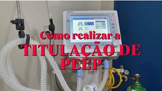 COMO REALIZAR A TITULAÇÃO DE PEEP método wevent ventilacaomecanica uti fisioterapia [upl. by Nymsaj]