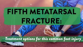 Fifth metatarsal fracture Treatment options for this common foot injury [upl. by Eelirol182]