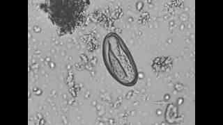 Ovo de Enterobius vermicularis com larva [upl. by Coray]