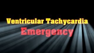 Ventricular Tachycardia Emergency [upl. by Elicia124]