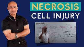 Necrosis Cell Injury  Apoptosis  General Pathology🦠 [upl. by Ettevets]