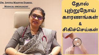 Melanoma Cancer in tamil  Causes  Symptoms Treatment  Dr Jovita Martin Daniel [upl. by Inahet]