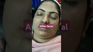 Anti pigmentation facial [upl. by Lehpar]