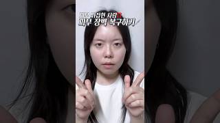 협찬 피부 뒤집힌 사람⁉️ 피부 장벽 복구하기💉듀이트리 [upl. by Kathye74]