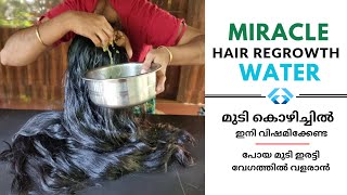 Miracle Hair Regrowth Water get Healthy scalp Nourish and Grow Hair [upl. by Lemar]