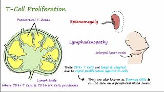 Mono  Pathophysiology Symptoms Diagnosis amp Treatment [upl. by Yelsek908]