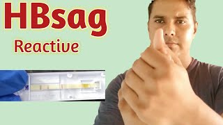 HBsag Blood Test  Hbsag test  Hepatitis B virus  Hepatitis surface antigen test [upl. by Airotnahs]