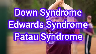 Down SyndromeEdwards Syndrome And Patau Syndrome [upl. by Gaye]