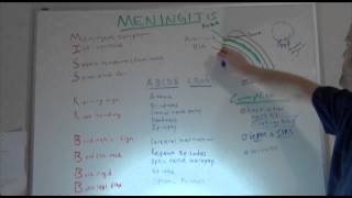 Meningitis Overview NCLEX Neuro Review  NURSINGcom NRSNGcom [upl. by Spiegleman]