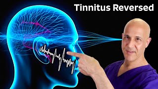 Tinnitus Reversed The Miracle of 1 Nutrient Dr Mandell [upl. by Colon124]