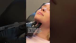 An FDAApproved Double Chin Solution [upl. by Nerfe]