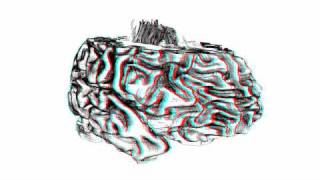 DTI in Context Illustrating Brain Fiber Tracts In Situ anaglyphic [upl. by Emogene984]