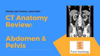 CT Anatomy Review Abdomen amp Pelvis [upl. by Arin]