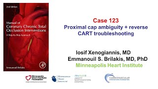 Case 123 Manual of CTO Interventions Proximal cap ambiguity  reverse CART troubleshooting [upl. by Finah]