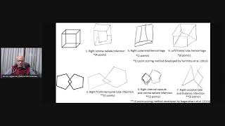 Constructional apraxia in brain jaundice in COVID time [upl. by Eimerej825]