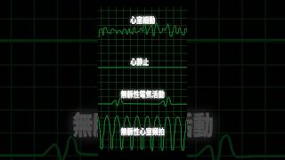 心停止の波形は4種類 心電図 看護師 心室頻拍 心室細動 無脈性電気活動 心静止 [upl. by Ravel]