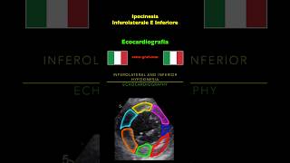 Ecocardiografia  Ipocinesia Inferolaterale E Inferiore [upl. by Matrona963]