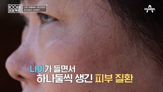 질병을 부르는 활성산소 활성산소 과다의 첫 번째 징후 피부를 주목하라  100세 프로젝트 140 회 [upl. by Naus]