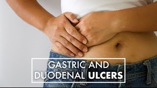 Gastric Ulcers vs Duodenal Ulcers  Dr Jeffrey Linder  Top10MD [upl. by Cottle]