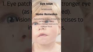 Amblyopia An Eye Issue amp Home Remedies [upl. by Thorman603]