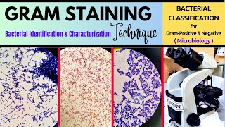 Gram Staining ProcedureMicrobiological TechniqueA Complete Technique BAM R32 [upl. by Ymrots]