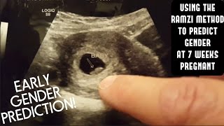 EARLY GENDER PREDICTION  RAMZI METHOD  7 WEEKS PREGNANT [upl. by Cofsky997]