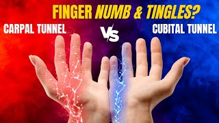 Causes for Numb Fingers Carpal tunnel vs Cubital tunnel syndrome [upl. by Toney270]