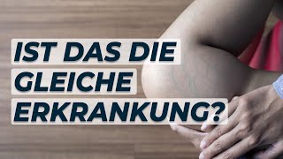 Zusammenhang zwischen HÄMORRHOIDEN und KRAMPFADERN Dr Eduard Karsten klärt auf [upl. by Akeimahs]