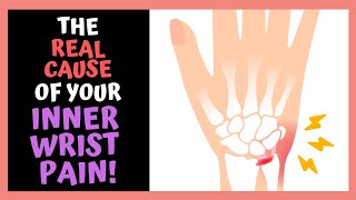 The REAL CAUSE Of Your INNER WRIST PAIN [upl. by Raddie]