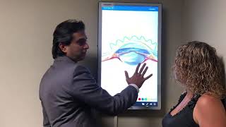 keratoconus Correction to 2020 with LaZrPlastique Gulani Keratoconus Protocols [upl. by Andriette692]