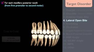 CC359 Discrepancy Index DI Part 1 [upl. by Groscr]