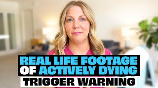 Breathing and Actively Dying Real Footage For Education [upl. by Perzan]