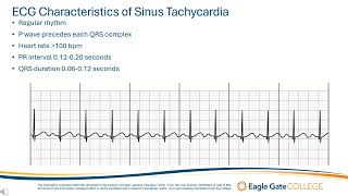 Sinus Tachycardia [upl. by Dragde]