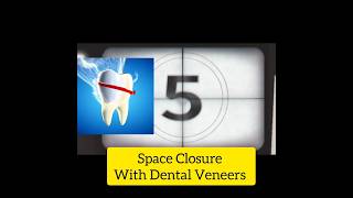 Closing That Gap A Guide to DiastemaSpacing Treatment yt shorts ytshortsindia dentis [upl. by Ankeny]