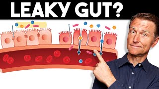 7 Signs of a Leaky Gut — Dr Berg [upl. by Bergess]