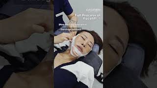 Full Process of Facelift 3 facelift koreaplasticsugery DrKwakMinho dasipiumplasticsurgery [upl. by Annaerda]