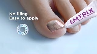 Emtrix Fungal Nail Treatment [upl. by Nierman]